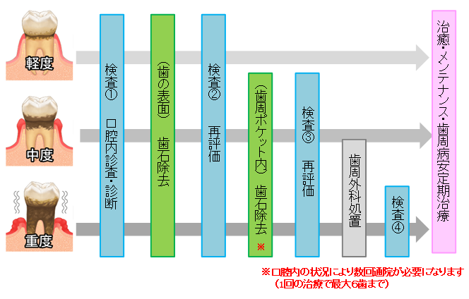 歯周病治療の流れ（保険診療）